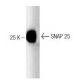 SNAP 25 Antibody (20) - Western Blotting - Image 127502 