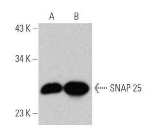 western blotting image from recommended SNAP 25 (SP12) monoclonal antibody replacement. Image 370740