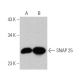 western blotting image from recommended SNAP 25 (SP12) monoclonal antibody replacement. Image 370740