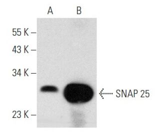 SNAP 25 Antibody (SP14) - Western Blotting - Image 358438 