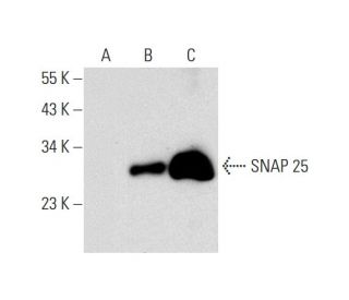 SNAP 25 Antibody (20) - Western Blotting - Image 130139