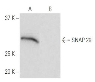 SNAP 29 Antibody (9-YD11) - Western Blotting - Image 65056