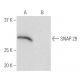 SNAP 29 Antibody (9-YD11) - Western Blotting - Image 65056
