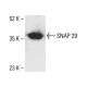 SNAP 29 Antibody (E-5) - Western Blotting - Image 405096