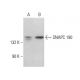 SNAPC 190 Antibody (B-11) - Western Blotting - Image 383958