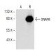 SNARK Antibody (H-3) - Western Blotting - Image 151174
