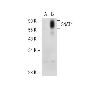 SNAT1 Antibody (H-9) - Western Blotting - Image 55464 