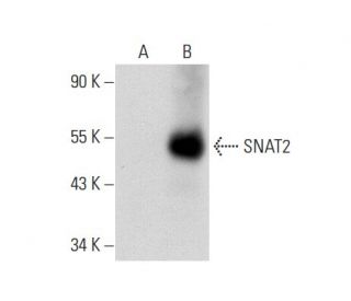 SNAT2 Antibody (G-8) - Western Blotting - Image 72960 