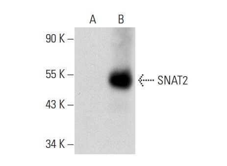 SNAT2 Antibody (G-8): sc-166366