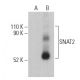 SNAT2 Antibody (G-8) - Western Blotting - Image 400919