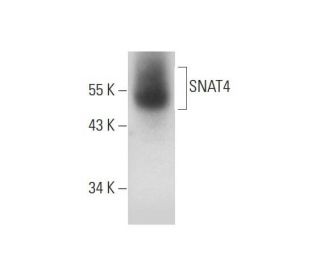 SNAT4 Antibody (A-4) - Western Blotting - Image 314583 
