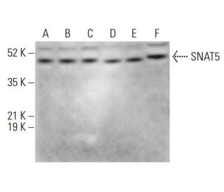 SNAT5 Antibody (G-7) - Western Blotting - Image 379038 