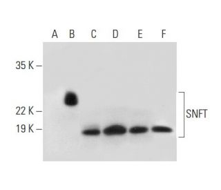 SNFT Antibody (D-6) - Western Blotting - Image 309532SAM Transcription Activation: SAM system utilizing dCas9-VP64, MS2-P65-HSF1, and sgRNA for precise gene transcription activation.