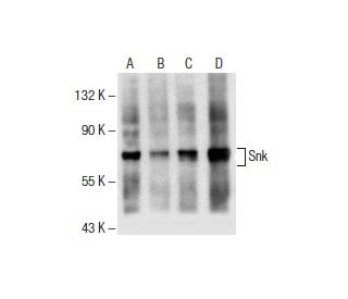 western blotting image from recommended Snk (E-10) monoclonal antibody replacement. Image 154917