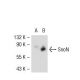 SnoN Antibody (B-3) - Western Blotting - Image 54070