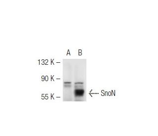 SnoN Antibody (C6) - Western Blotting - Image 45292 