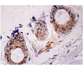 immunohistochemistry image from recommended SnoN (B-3) monoclonal antibody replacement. Image 158091