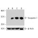 Anticuerpo Snurportin-1 (C-1): sc-390155. Análisis mediante Western blot de la expresión de Snurportin-1 en lisados celulares completos K-562 no tratados (A), K-562 tratados químicamente (B), HCT-116 (C) y HeLa (D). Reactivo de detección utilizado: m-IgG1 BP-HRP: sc-525408. β-Actina (C4): sc-47778 utilizado como control de carga. Reactivo de detección utilizado: m-IgG Fc BP-HRP: sc-525409.  Snurportin-1 Antibody (C-1) - Western Blotting - Image 415018