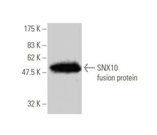 SNX10 Antibody (1G5) - Western Blotting - Image 349570
