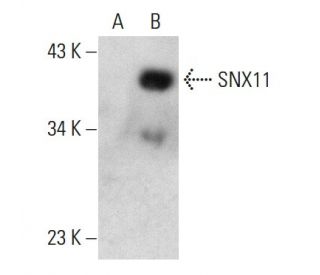 SNX11 Antibody (2G1) - Western Blotting - Image 384460 