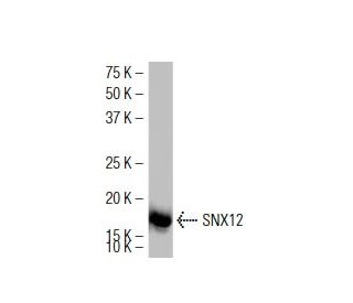 SNX12 Antibody (42-Y) - Western Blotting - Image 34665 