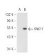 SNX17 Antibody (D-10) - Western Blotting - Image 93723