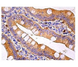 SNX17 Antibody (E-12) - Immunohistochemistry - Image 159185 