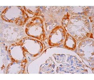 SNX19 Antibody (B-1) - Immunohistochemistry - Image 293434 
