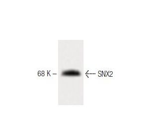 SNX2 Antibody (13) - Western Blotting - Image 60442 