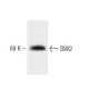 SNX2 Antibody (13) - Western Blotting - Image 60442 