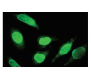 SNX29 Antibody (4B12) - Immunofluorescence - Image 67388 