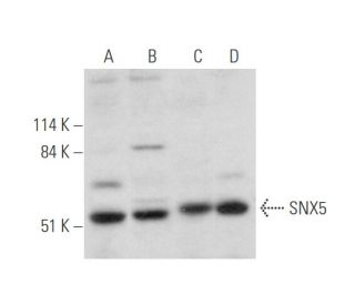 SNX5 Antibody (F-11) - Western Blotting - Image 344572 