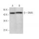 SNX5 Antibody (F-11) - Western Blotting - Image 373456