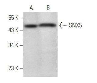 SNX5 Antibody (F-11) - Western Blotting - Image 373456Each CRISPR/Cas9 Knockout (KO) Plasmid product consists of a pool of 3 plasmids designed to ensure identification and cleavage of a specific gene for maximum knockout efficiency. Each plasmid encodes a unique 20 nt sequence derived from the GeCKO (v2) library.