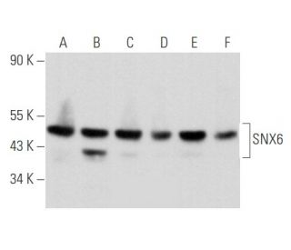 SNX6 Antibody (D-5) - Western Blotting - Image 357387 