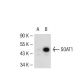 SOAT1 Antibody (A-11) - Western Blotting - Image 54076 
