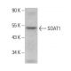 SOAT1 Antibody (A-11) - Western Blotting - Image 382282