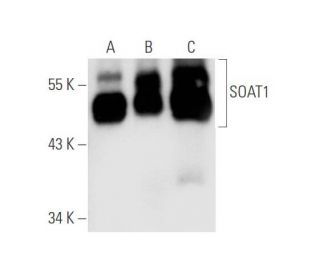 SOAT1 Antibody (D-1) - Western Blotting - Image 56378 