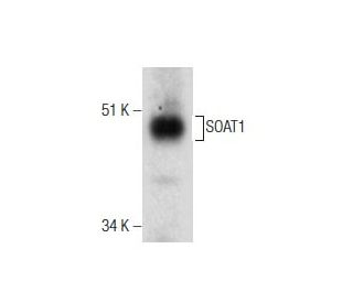 western blotting image from recommended SOAT1 (D-1) monoclonal antibody replacement. Image 164445