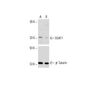 SOAT1 siRNA (m): sc-29625. Western blot analysis of SOAT1 expression in non-transfected control (A) and SOAT1 transfected 