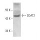 SOAT2 Antibody (ACAT-2) - Western Blotting - Image 15862