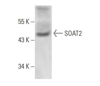 SOAT2 Antibody (ACAT-2) - Western Blotting - Image 15862SAM Transcription Activation: SAM system utilizing dCas9-VP64, MS2-P65-HSF1, and sgRNA for precise gene transcription activation.