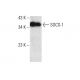 This polyclonal antibody has been discontinued. See our recommended <a href="socs-1-antibody-e-9">SOCS-1 (E-9)</a> monoclonal antibody (sample data shown). western blotting image from recommended SOCS-1 (E-9) monoclonal antibody replacement. Image 386920