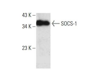 western blotting image from recommended SOCS-1 (E-9) monoclonal antibody replacement. Image 386920