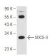SOCS-3 Antibody (6A463) - Western Blotting - Image 81138