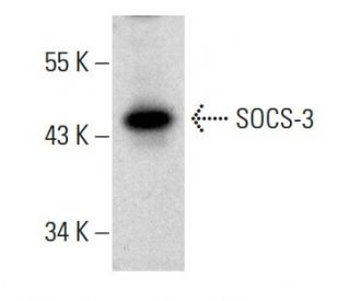 western blotting image from recommended SOCS-3 (G-5) monoclonal antibody replacement. Image 385937
