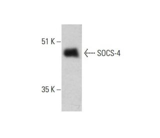 SOCS-4 Antibody (9J12) - Western Blotting - Image 384298 