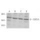 SOCS-5 Antibody (31-L) - Western Blotting - Image 367990 