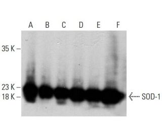 Superoxide Dismutase 1/SOD1 Antibody (24) - Western Blotting - Image 387971 