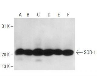 Superoxide Dismutase 1/SOD1 Antibody (72B1) - Western Blotting - Image 15857 